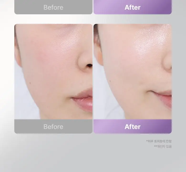 [슈링크홈콜라보|디바이스] 바이오힐보 프로바이오덤 콜라겐 세럼 30ml 슈링크홈기획(+콜라겐겔마스크) 상세페이지 7